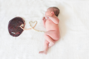 Cord blood banking vs delayed cord clamping. Can I do both – Hayley Oakes LM, CPM