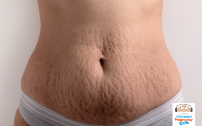 Understanding Stretch Marks