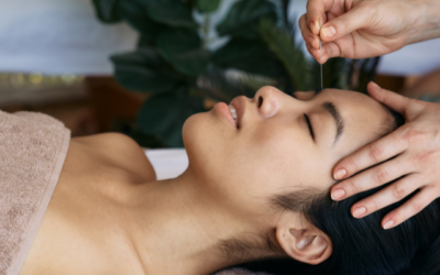 Acupuncture for Fertility